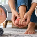 Toe Infection Causes, Symptoms & Treatment Options